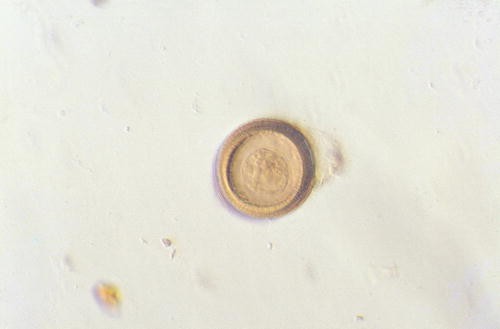 Taenia solium | SpringerLink