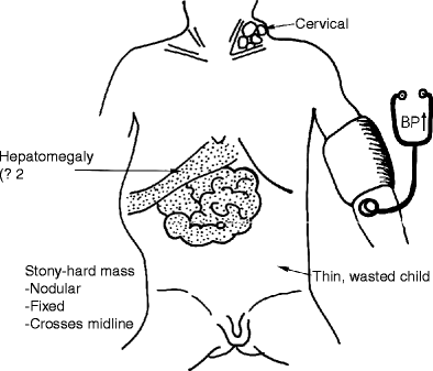 Mass of the right flank.  Download Scientific Diagram