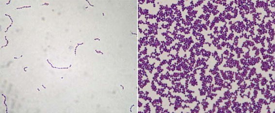 Staphylococcus aureus under microscope: microscopy of Gram-positive cocci,  morphology and microscopic appearance of Staphylococcus aureus, S.aureus  gram stain and colony morphology on agar, clinical significance