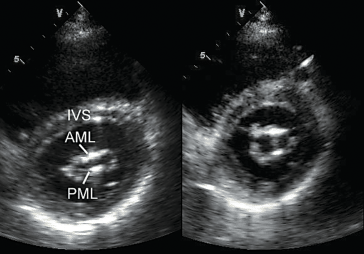 figure 101