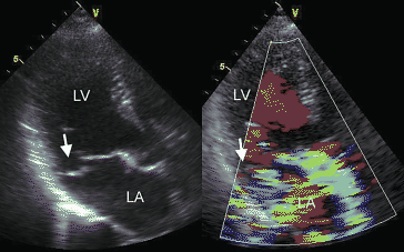 figure 103