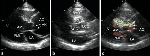 figure 107