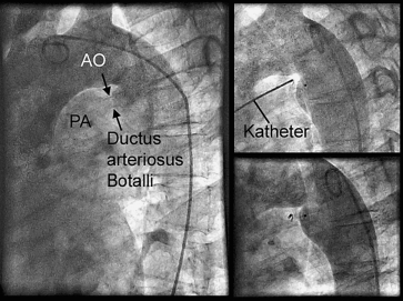 figure 112