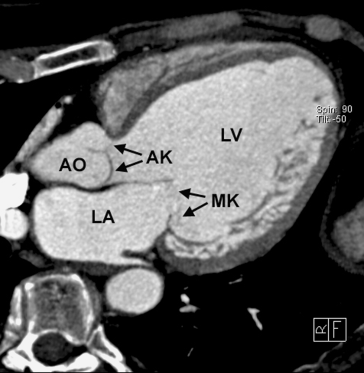 figure 113