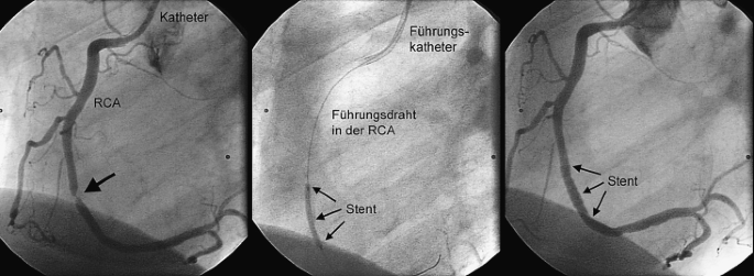 figure 117