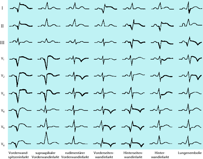 figure 120