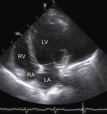 figure 121