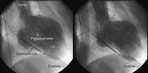 figure 122