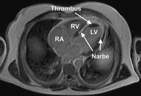 figure 123