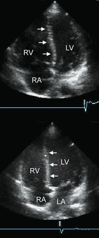 figure 125