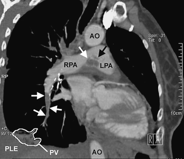 figure 127