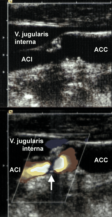 figure 26