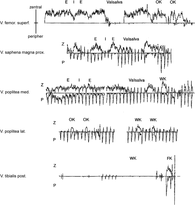 figure 33