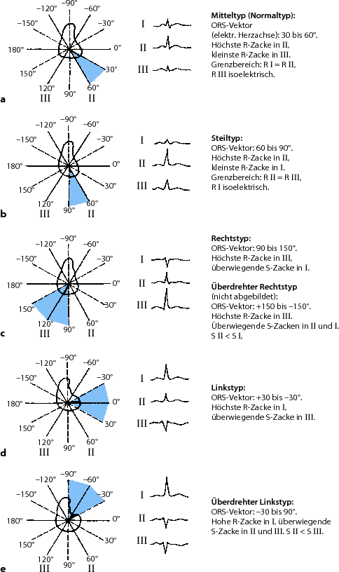 figure 44