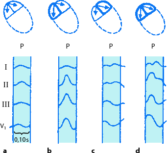 figure 46