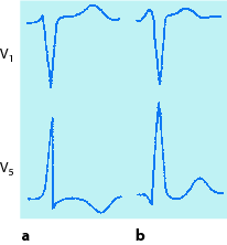 figure 48