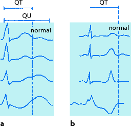 figure 51