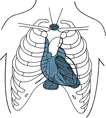 figure 55