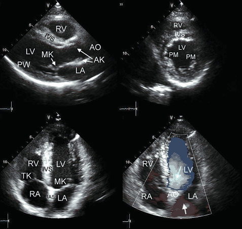 figure 57