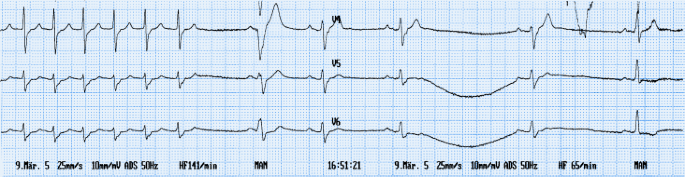 figure 77