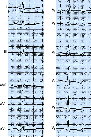 figure 89