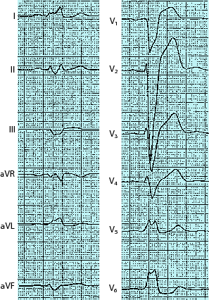 figure 90