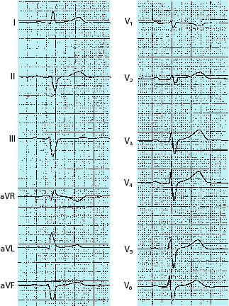 figure 92