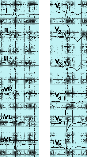 figure 94