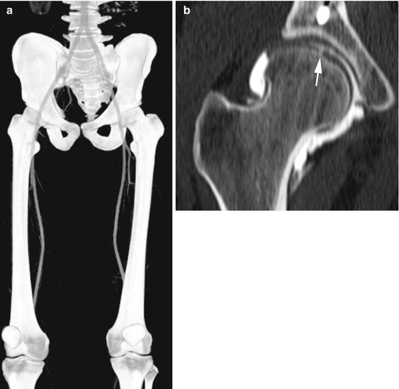 https://media.springernature.com/lw685/springer-static/image/chp%3A10.1007%2F978-3-642-34746-7_12/MediaObjects/310002_1_En_12_Fig12_HTML.jpg