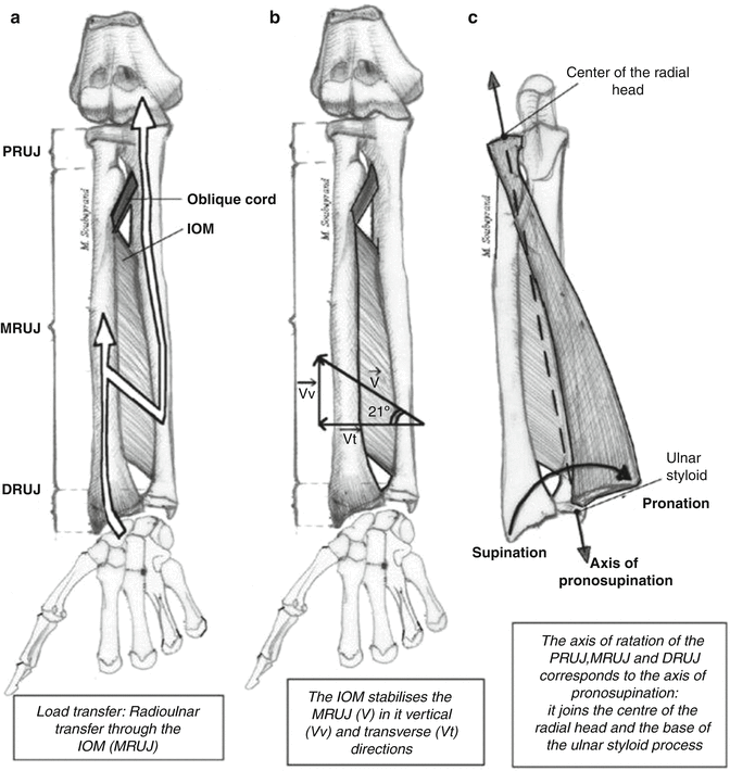 Supination/pronation of the forearm and hand occurs at which of