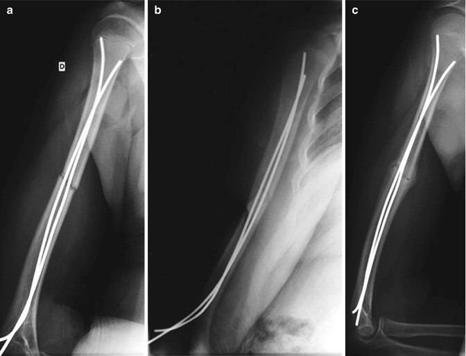 figure 20