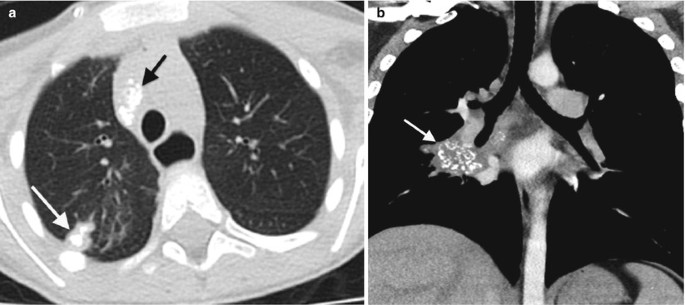 figure 25