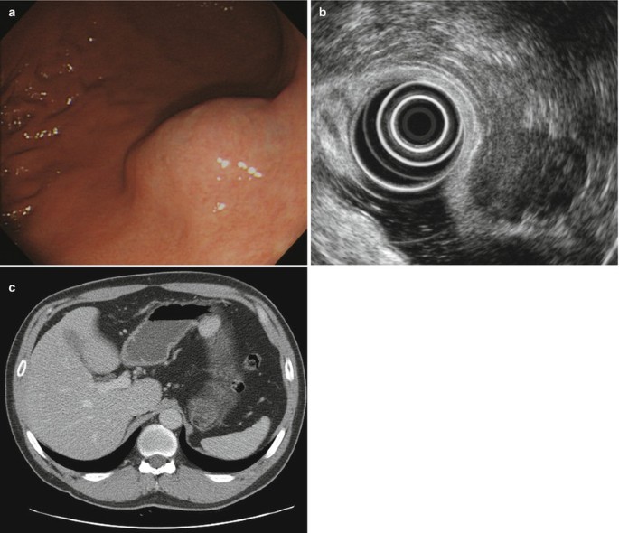 figure 14