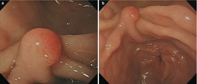 figure 32