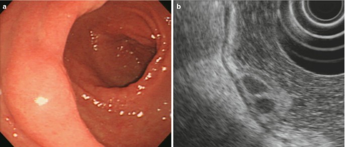 figure 45