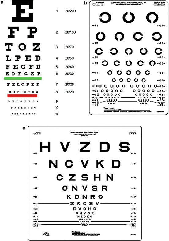 Figure, A Snellen eye chart for visual acuity testing.] - StatPearls - NCBI  Bookshelf