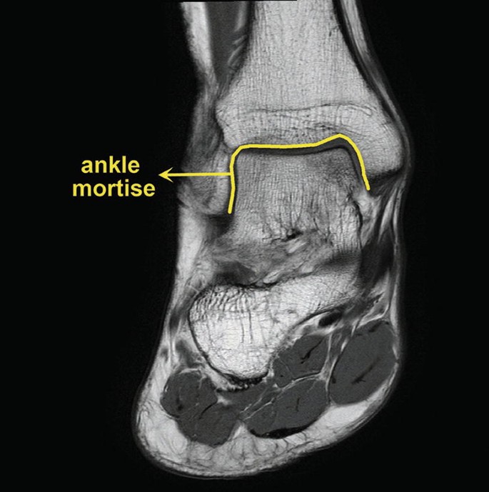 Anatomy of ankle joint