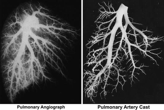 Braz J Cardiovasc Surg - The pulmonary vascular blood supply in