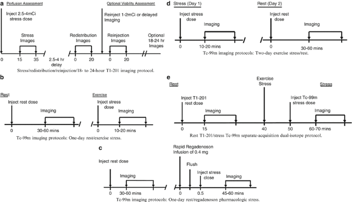 Assessment of Myocardial Viability Using Nuclear Medicine Imaging in  Dextrocardia