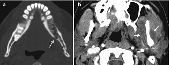 figure 18