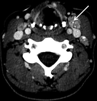 figure 18