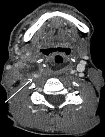 figure 25