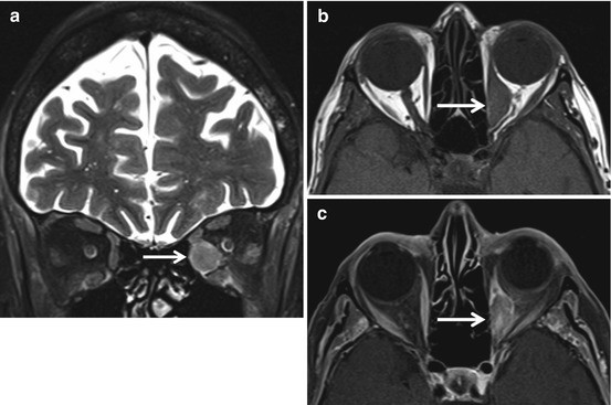 figure 24