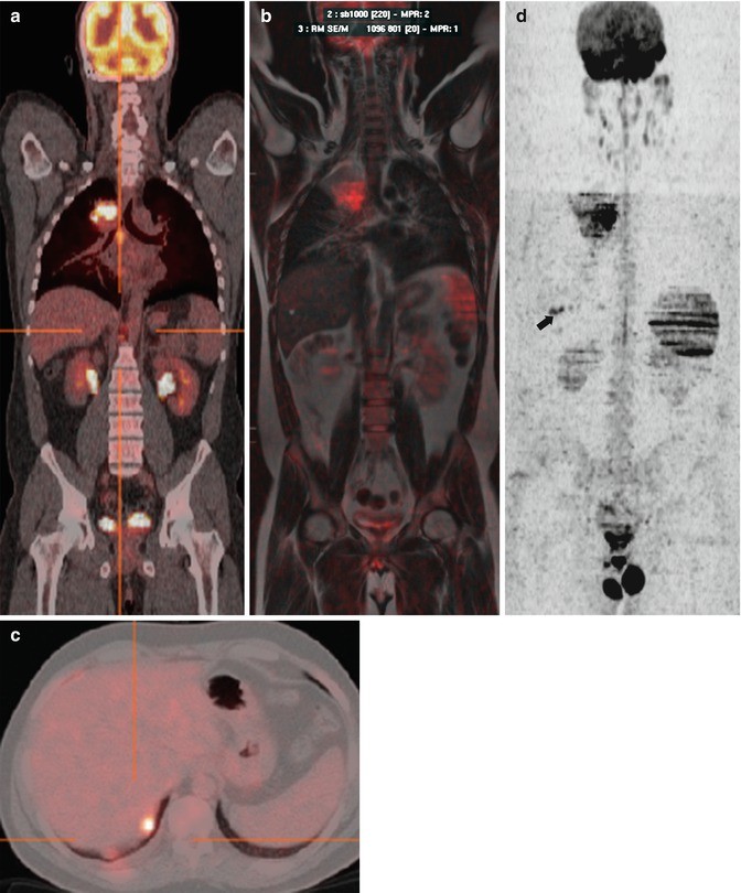 figure 16