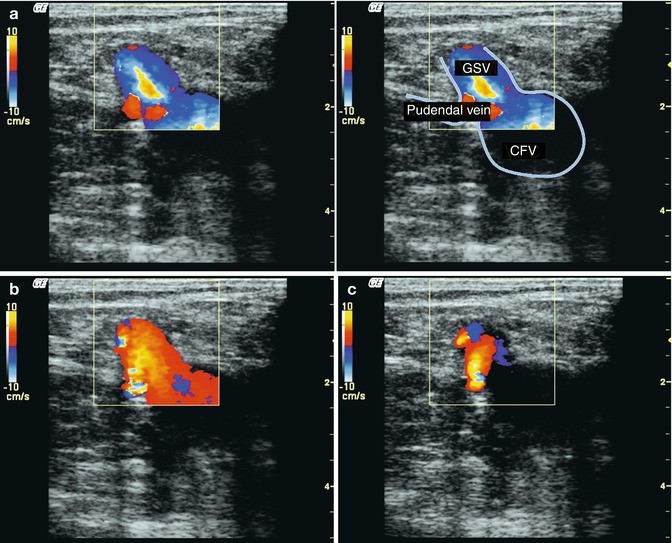 figure 19