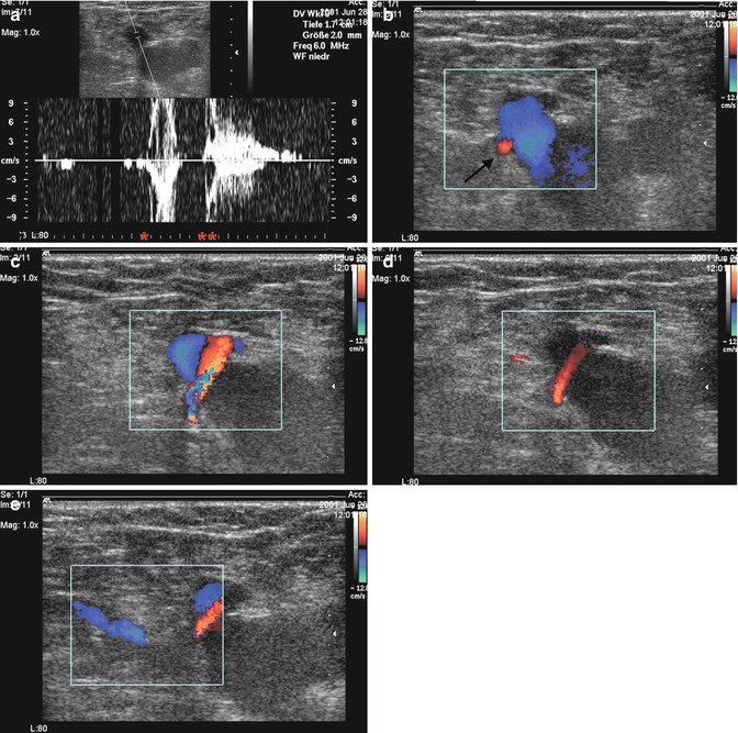 figure 21