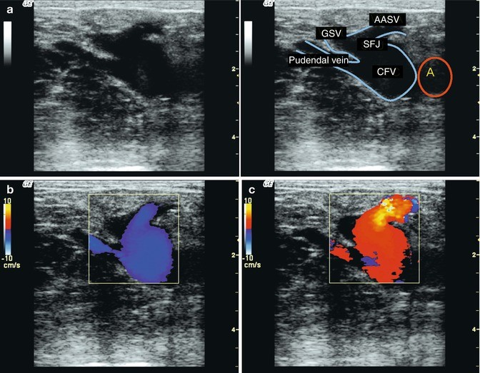 figure 26