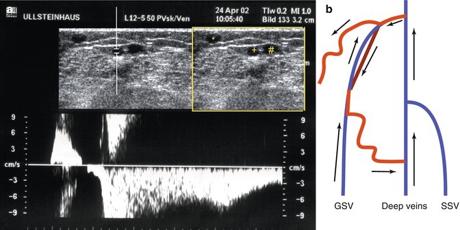 figure 38