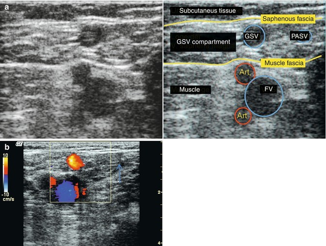 figure 40