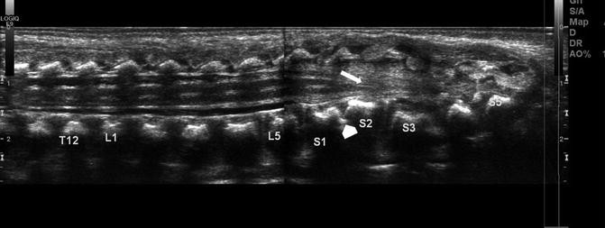 figure 32